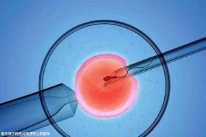 人工孕妈代怀咨询联系电话
